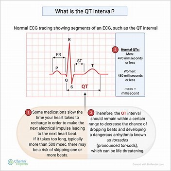 Qt Interval Type 1 Diabetes